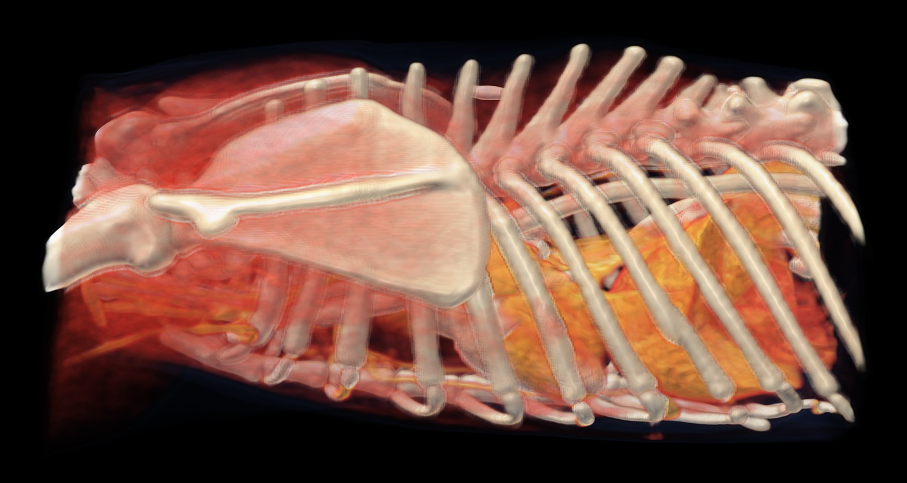 3D rekonštrukcia z CT
