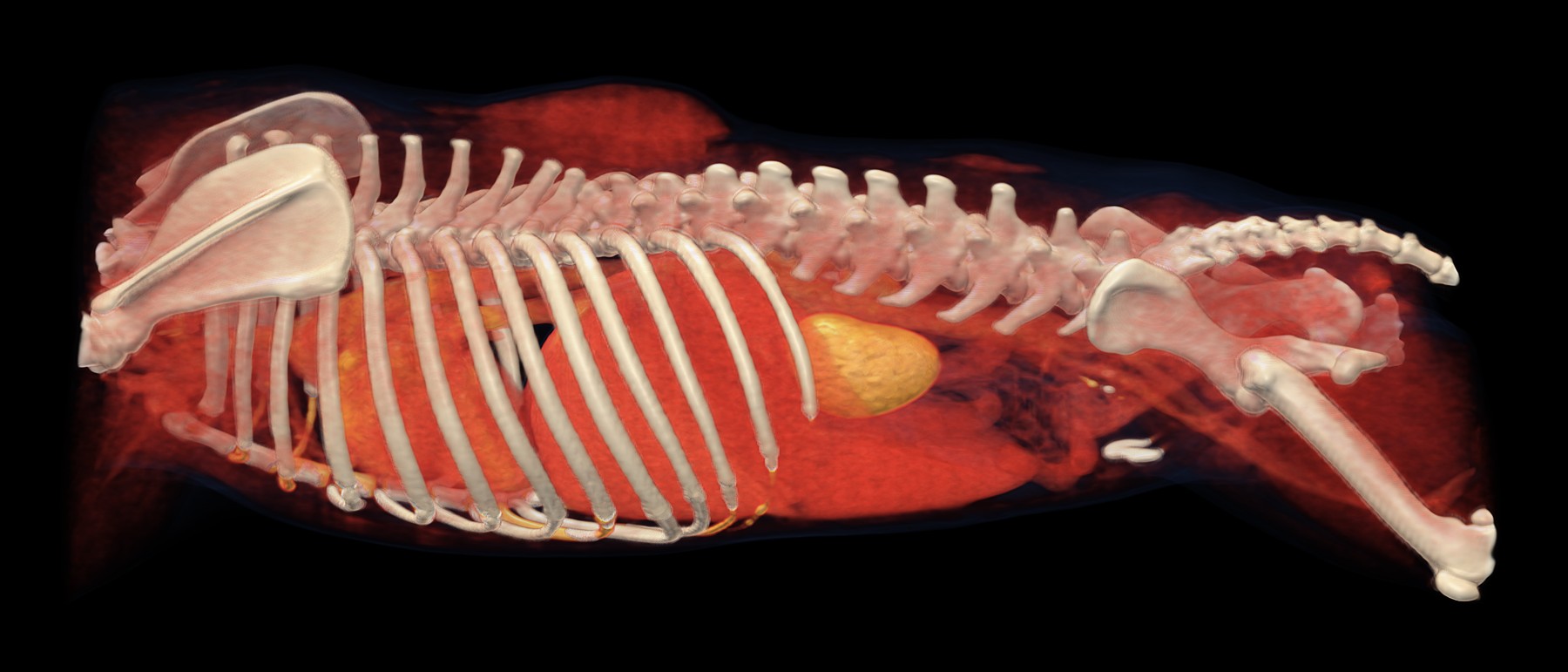3D rekonštrukcia z CT