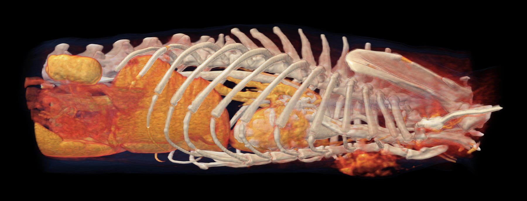 3D rekonštrukcia z CT