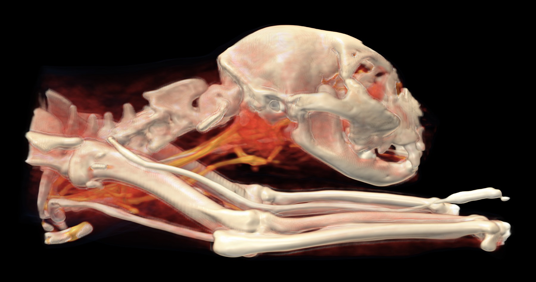 3D rekonštrukcia z CT