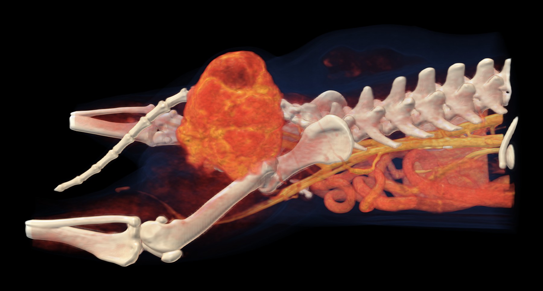 3D rekonštrukcia z CT